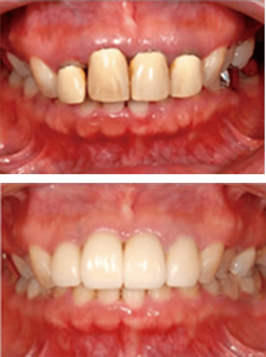 上京区新烏丸信富町・yoshiko（よしこ）歯科クリニック