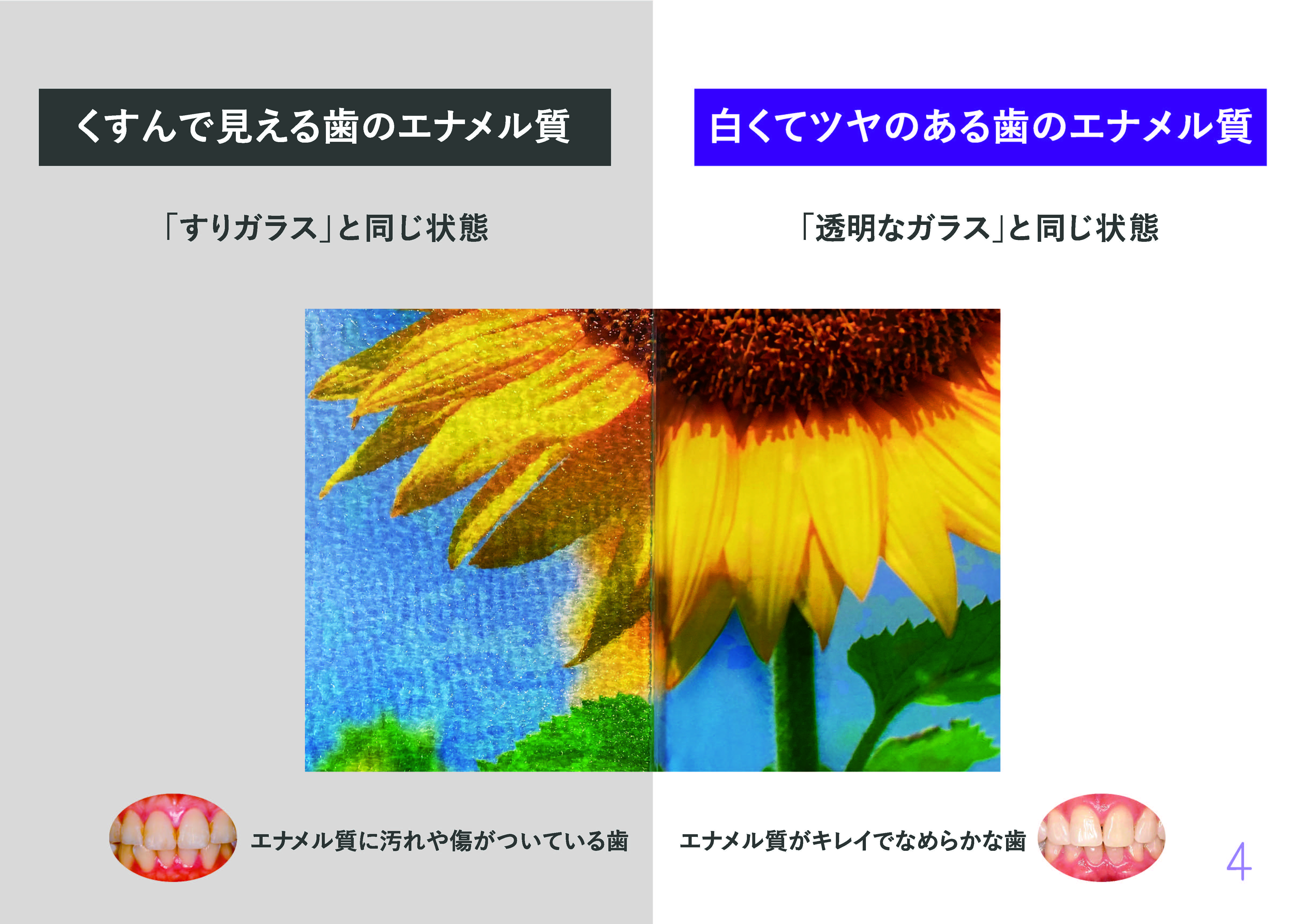 yoshiko（よしこ）歯科クリニックPMTCトリートメント